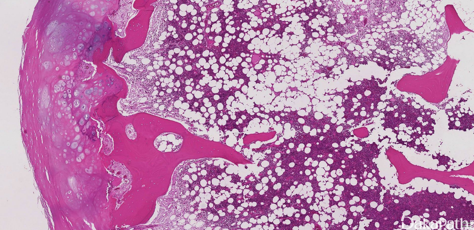 骨巨细胞瘤影像表现-医学影像图,_医学图库