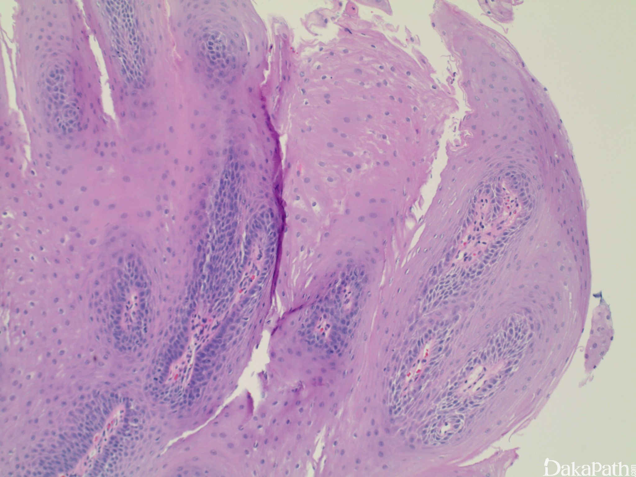 组织病理学图集 | 犬恶性乳腺肿瘤：导管内乳头状乳腺癌 - 知乎