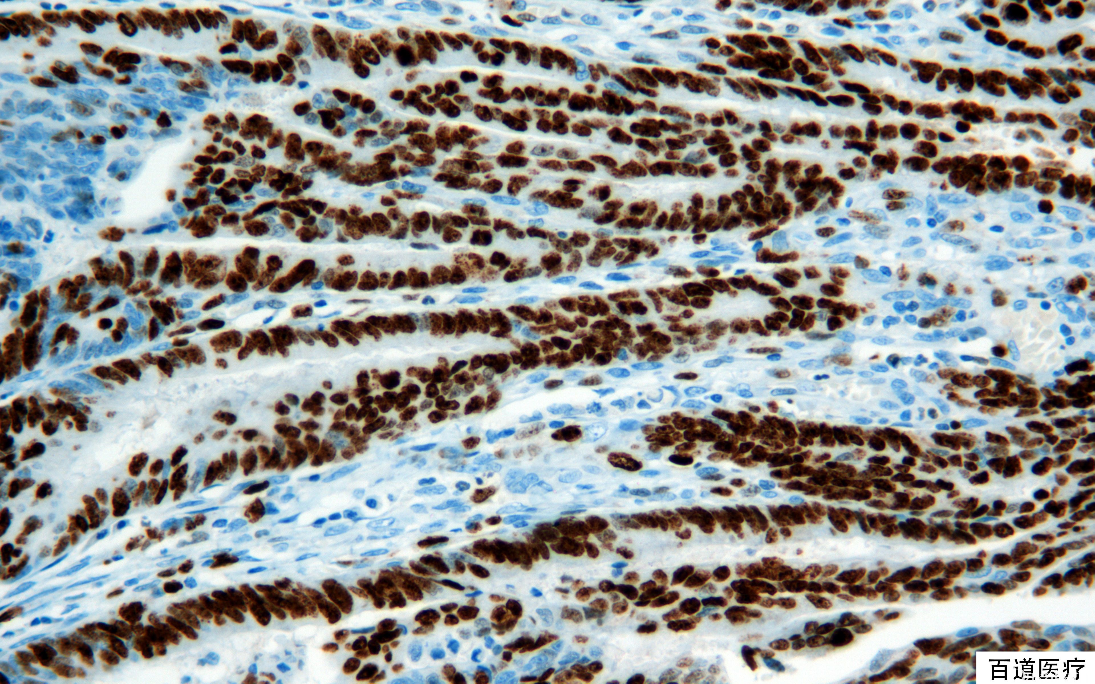 正常小鼠睾丸Sertoli细胞 TM4（STR鉴定正确）_细胞系_细胞库_旗赛生物科技（武汉）有限公司