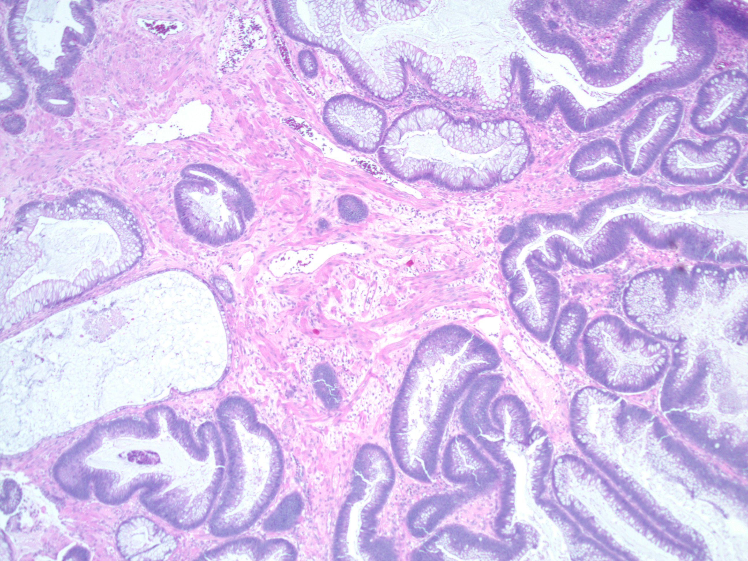 显微镜下肠道腺瘤病人体病理标本_4096X2160_高清视频素材下载(编号:7886861)_实拍视频_光厂(VJ师网) www.vjshi.com