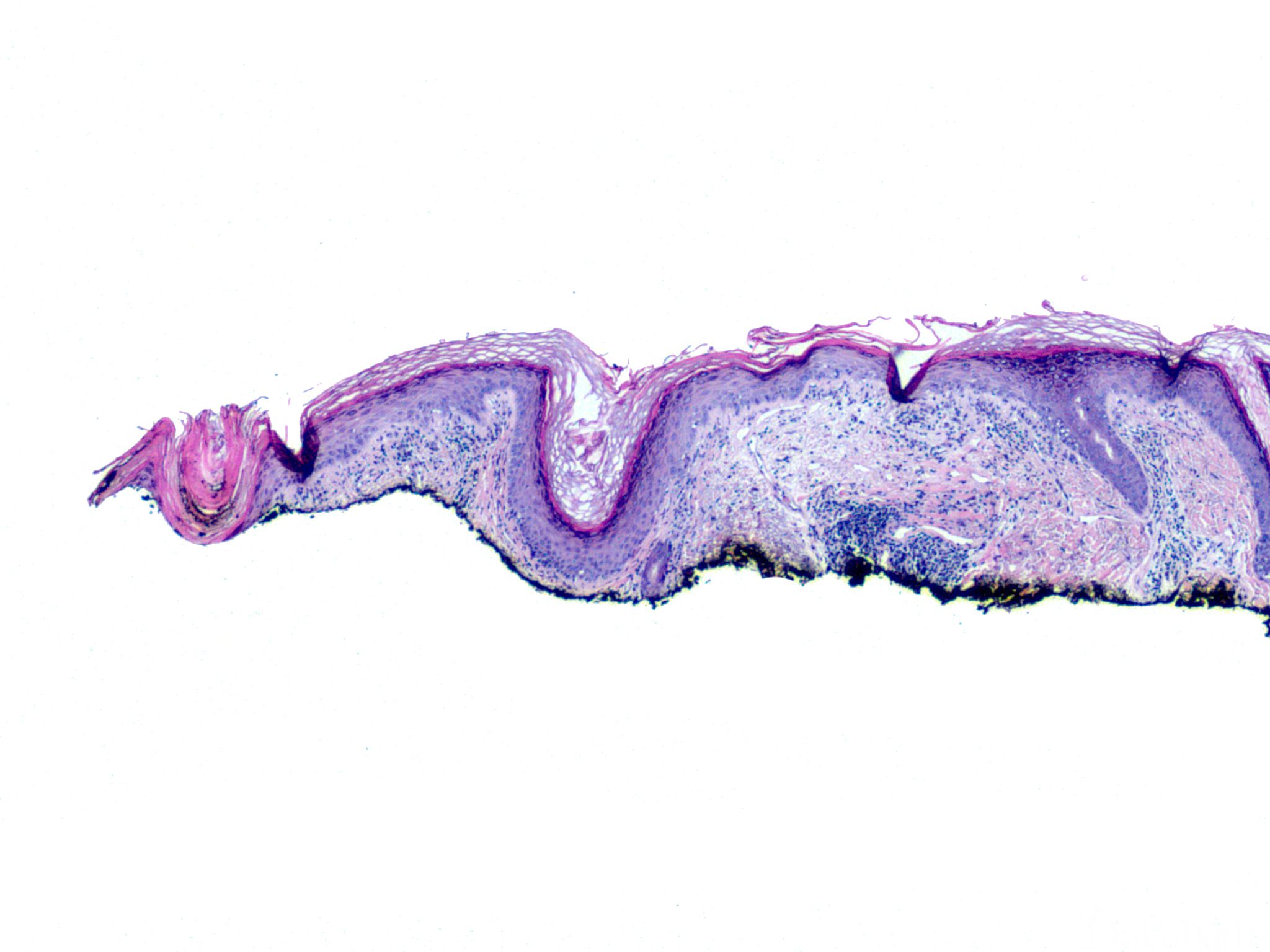 图285 红斑狼疮细胞及其花团簇期-心血管-医学