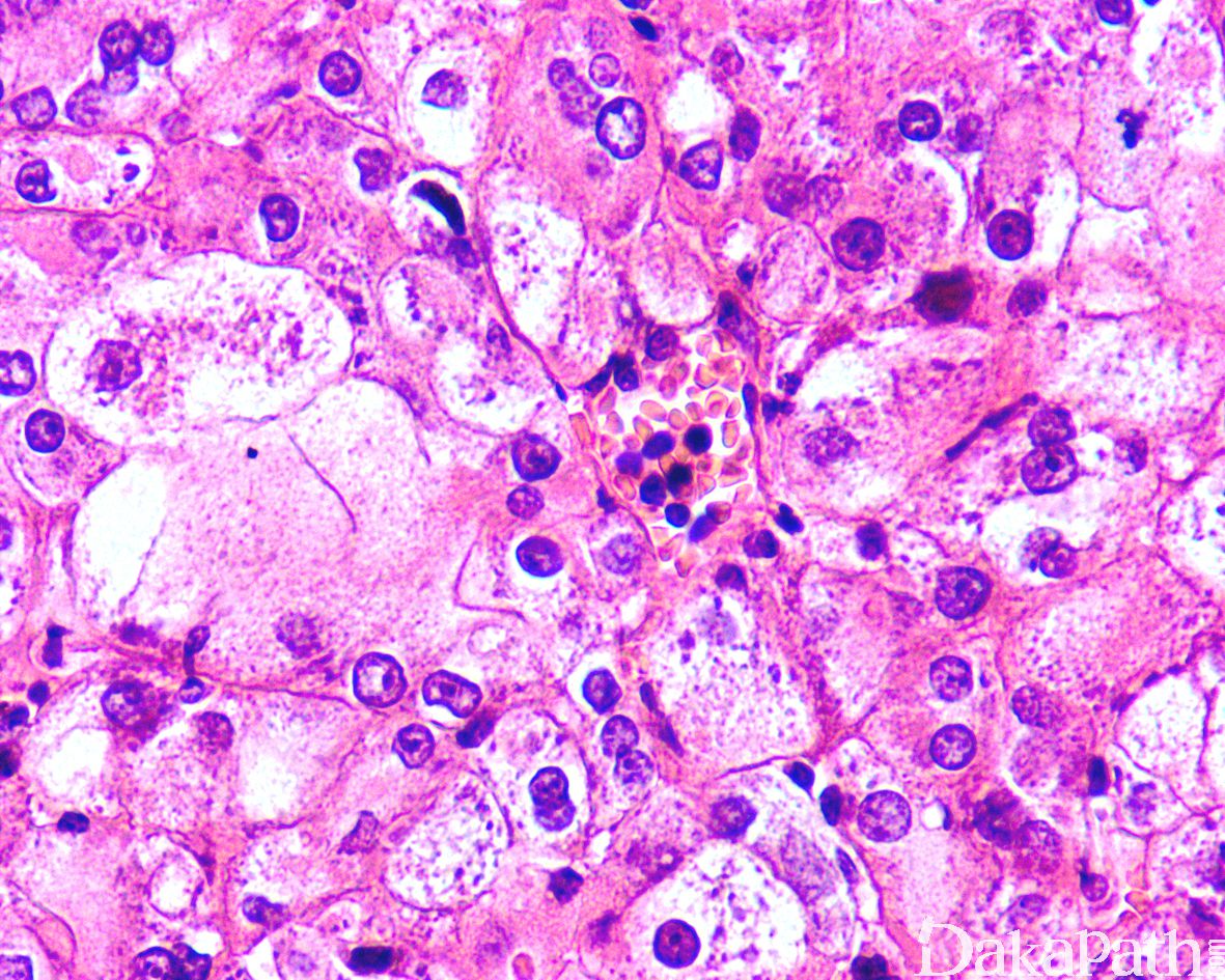 从鼻腔到法氏囊，IBDV 感染鸡法氏囊的单细胞测序机制研究 - 知乎