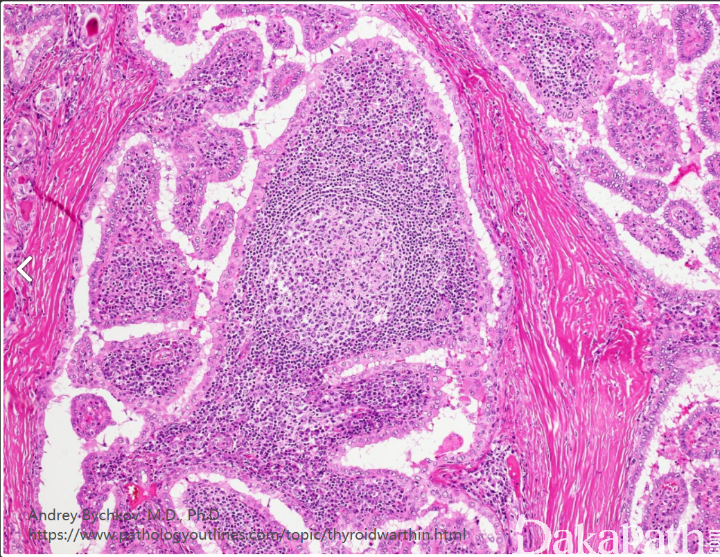 人乳头瘤病毒HPV的细胞结构插画图片素材_ID:376819714-Veer图库
